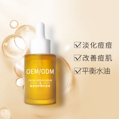 荆州市_祛痘精华原液OEM